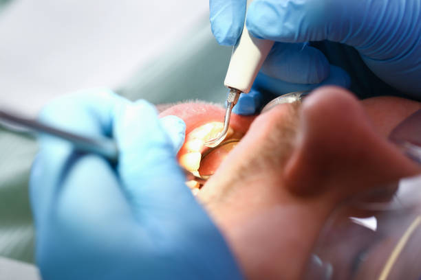 Best Urgent Care for Lost Fillings or Crowns in Falls Creek, PA