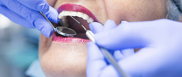 Best Emergency Wisdom Teeth Removal in Falls Creek, PA